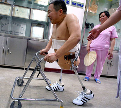 Peng Shulin on his artificial legs