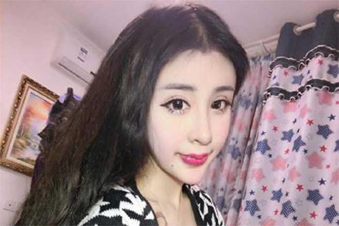 15 Year Old Chinese Girl Has Extreme Plastic Surgery And Social Network